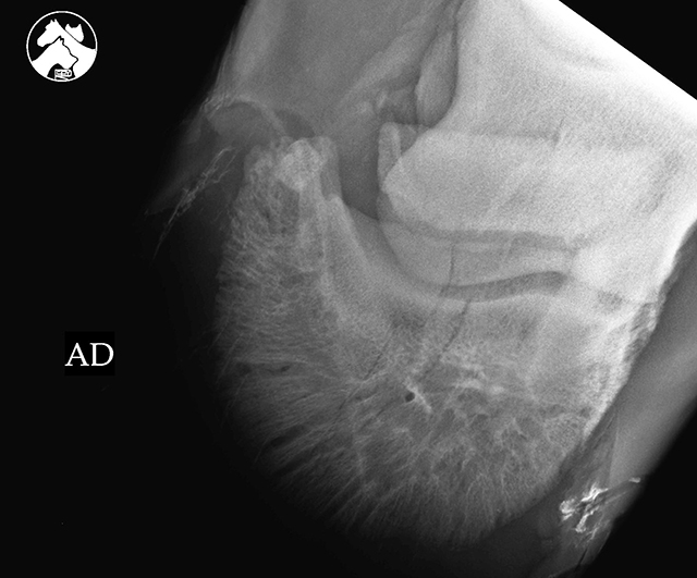 Radiografía casco fractura