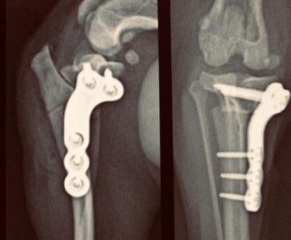 Ocultación hijo promesa Osteotomía de nivelación de la meseta tibial (TPLO) para tratamiento de la  rotura del ligamento cruzado anterior - Hospital Veterinario San Vicente